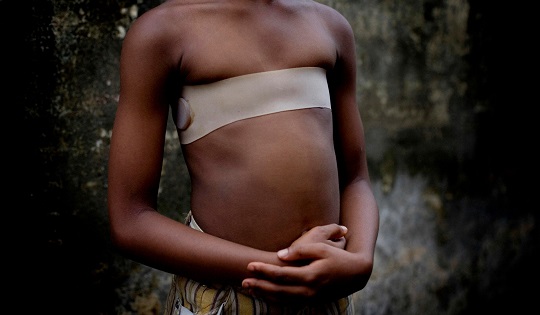 Breast ironing: un’altra violenza contro le donne